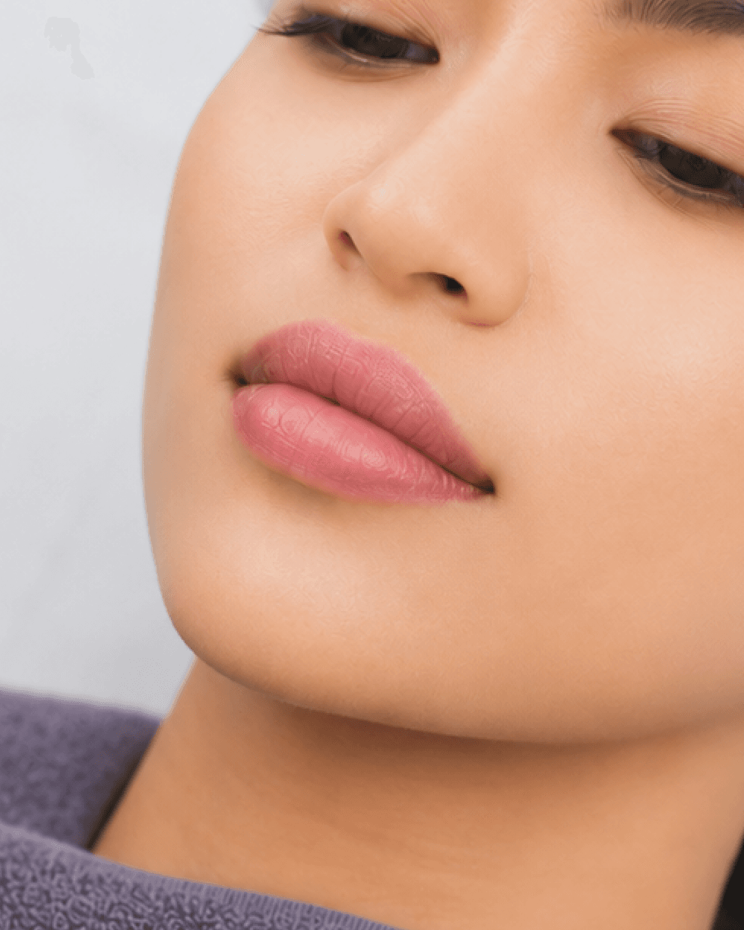 Foto treatment Cherry Lip Laser di MALVE Clinic