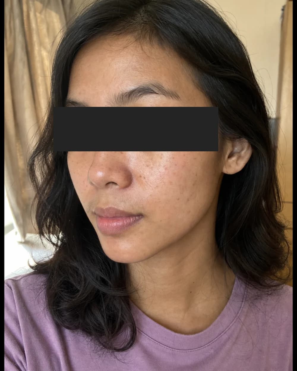 Kusam sebelum Brightening Facial