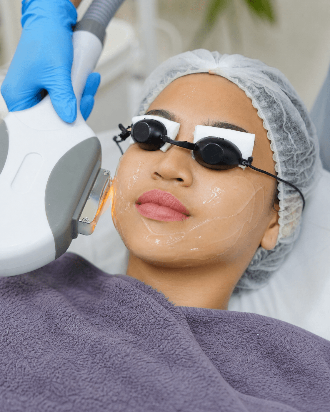 Foto treatment Hifu di MALVE Clinic